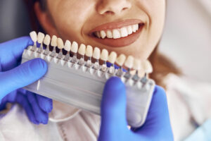 Carillas dentales: tipos, beneficios y cómo saber si son para ti