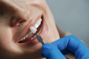 ¿Cuánto cuesta un implante dental en Guatemala? Todo lo que debes saber antes de cotizar