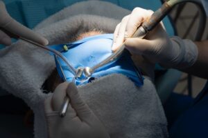 Implantes dentales: inversión vs beneficios a largo plazo