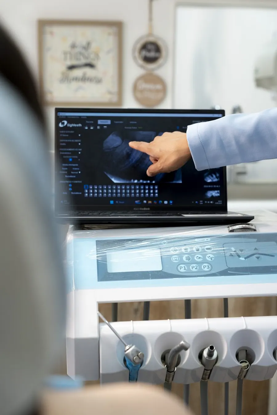 Radiografía dental digital en Clínica Dental Konamor