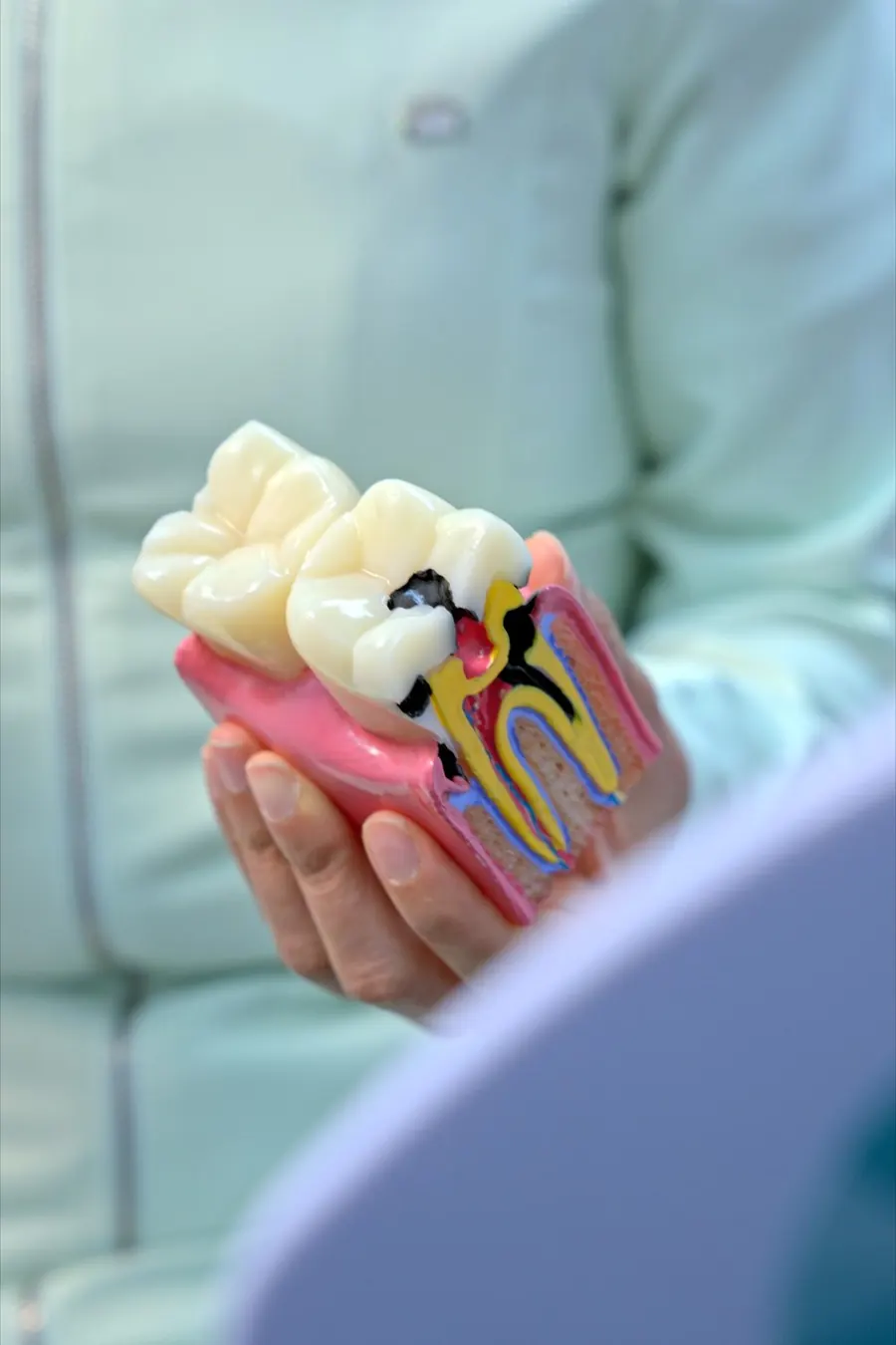 Modelo dental para explicar caries a pacientes